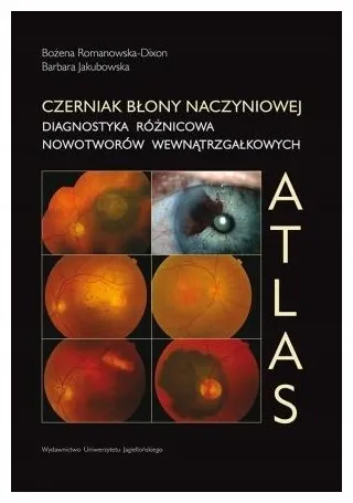 czerniak-blony-naczyniowej-diagnostyka