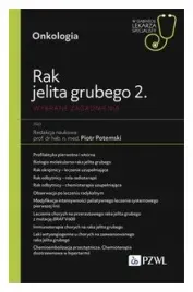 rak-jelita-grubego-2-wybrane-zagadnienia-