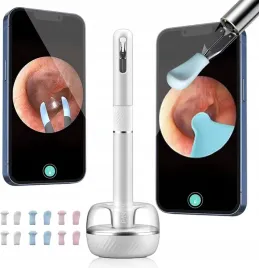 urzadzenie-do-czyszczenia-uszu-bebird-note5-pro-bialy