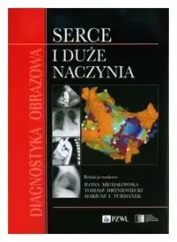 diagnostyka-obrazowa-serce-i-duze-naczynia