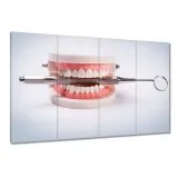 obrazy-120x80-proteza-dentystyczna