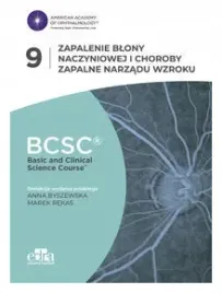 zapalenie-blony-naczyniowej-i-choroby-zapalne-narzadu-wzroku