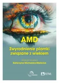 amd-zwyrodnienie-plamki-zoltej-zwiazane-z-wiekiem-katarzyna