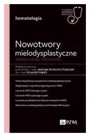 nowotwory-mielodysplastyczne-wspolczesne-spojrzenie-jadwiga