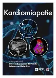 kardiomiopatie-katarzyna-mizia-stec