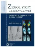 zespol-stopy-cukrzycowej