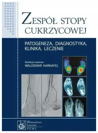 zespol-stopy-cukrzycowej