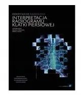 odkrywanie-radiologii-interpretacja-radiogramu