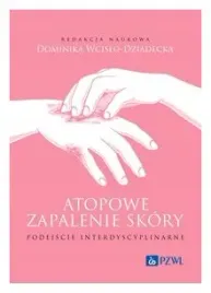 atopowe-zapalenie-skory-podejscie-interdyscyplinarne-dominika
