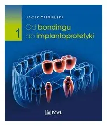 od-bondingu-do-implantoprotetyki-czesc-1