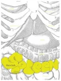 spleen-marta-szulc
