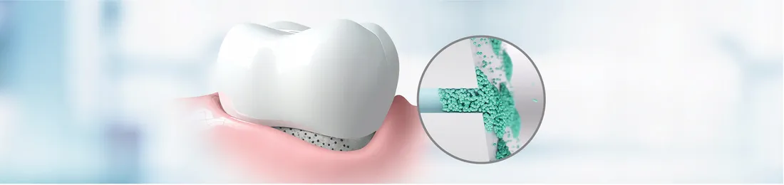 elmex-sensitive-pasta-do-zebow-75-ml-z-fluorem-pojemnosc-75-ml