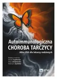 autoimmunologiczna-choroba-tarczycy-zycinska-katarzyna