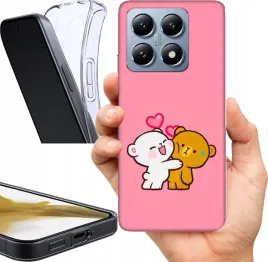 etui-na-xiaomi-14t-wzory-slodkie-dla-par