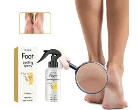 peeling-w-spray-u-do-stop-piet-zluszczania-martwego-naskorka-ouhoe-200-ml