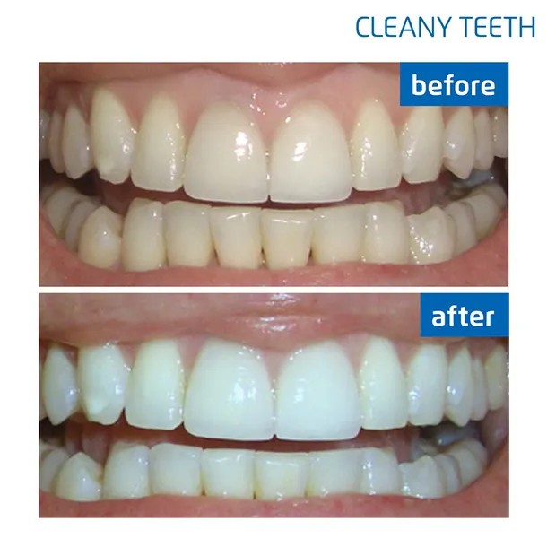 cleany-teeth-waga-z-opakowaniem-0-5-kg-produkt-wprowadzony-do-obrotu-na-terenie-ue-przed-13-12-2024-tak