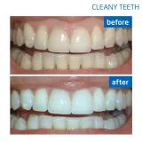 cleany-teeth-waga-z-opakowaniem-0-5-kg-produkt-wprowadzony-do-obrotu-na-terenie-ue-przed-13-12-2024-tak