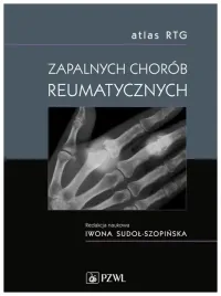 atlas-rtg-zapalnych-chorob-reumatycznych
