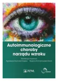 autoimmunologiczne-choroby-narzadu-wzroku