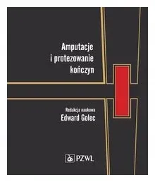 amputacje-i-protezowanie-konczyn