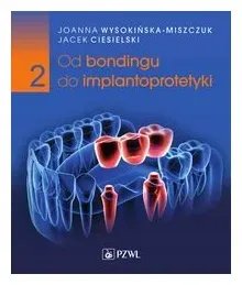 od-bondingu-do-implantoprotetyki-czesc-2-jacek