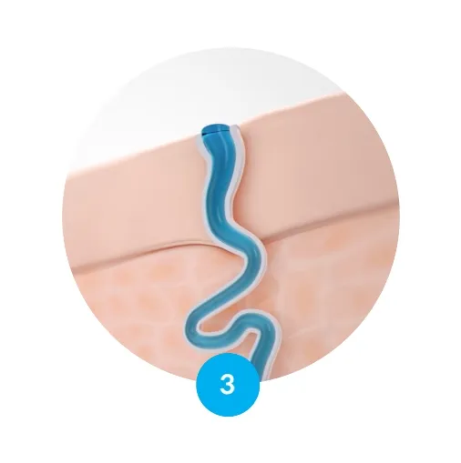 perspirex-men-maximum-roll-on-20-ml-typ-antyperspirant