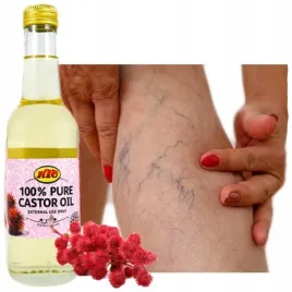 na-zylaki-i-pajaczki-uczucie-ciezkich-nog-olej-rycynowy-oryginalny-z