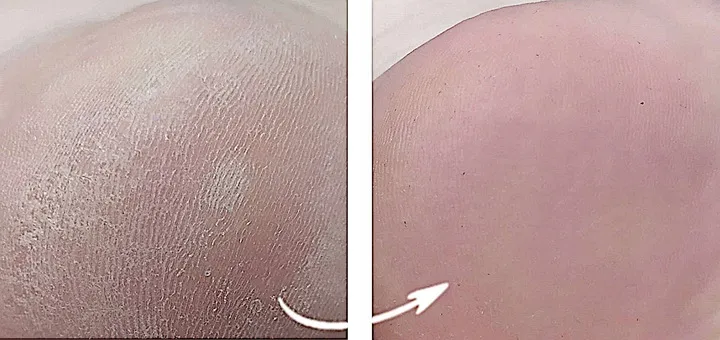 spray-z-jonami-srebra-na-grzybice-paznokci-3x100ml