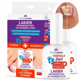 preparat-lakier-na-grzybice-grzybica-paznokci-stop-chroni-regeneruje