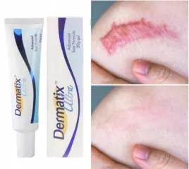 dermatix-zel-na-blizny-15-g