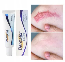 dermatix-ultra-silikonowy-zel-do-leczenia-i-zapobiegania-blizn-15g