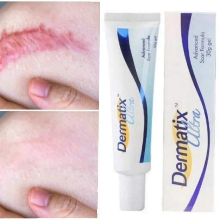 dermatix-zel-na-blizny-15-g