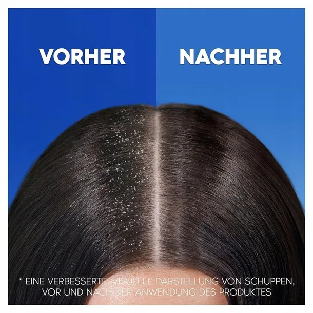 head-and-shoulders-classic-clean-szampon-800ml-produkt-nie-zawiera-skladnikow-pochodzenia-zwierzecego