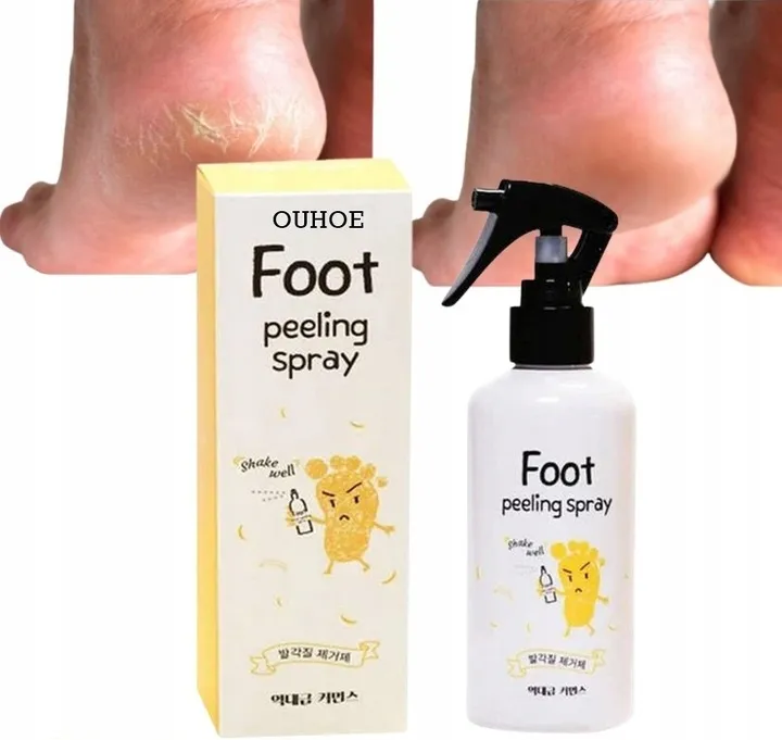 peeling-w-spray-u-do-stop-piet-zmiekcza-zluszcza-pielegnuje-200-ml