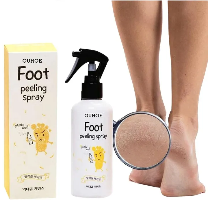 peeling-w-spray-u-do-stop-piet-zmiekcza-zluszcza-pielegnuje-200-ml