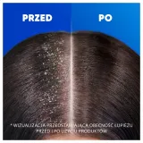 head-and-shoulders-classic-clean-szampon-800ml-wyrob-medyczny-nie