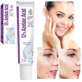 krem-na-tradzik-dla-skory-twarzy-przeciw-niedoskonalosciom-azelinowy-20-ml