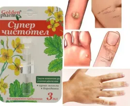 glistnik-bezbarwny-plyn-na-kurzajki-brodawki-wlokniaki-mocny-3ml-modzele