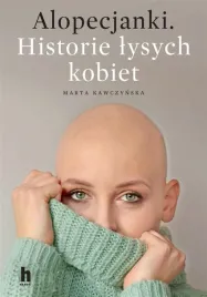 alopecjanki-historie-lysych-kobiet