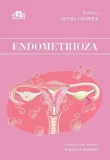 endometrioza-s-chopra