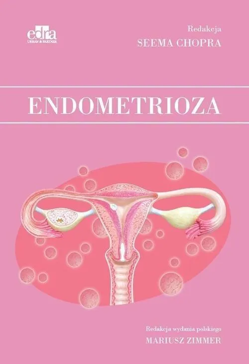 endometrioza-s-chopra