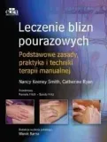 leczenie-blizn-pourazowych