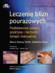 leczenie-blizn-pourazowych