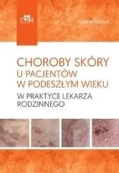 choroby-skory-u-pacjentow-w-podeszlym-wieku