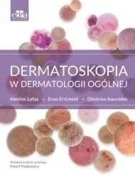 dermatoskopia-w-dermatologii-ogolnej
