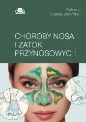 choroby-nosa-i-zatok-przynosowych-tomasz-zatonski