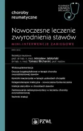 nowoczesne-leczenie-zwyrodnienia-stawow