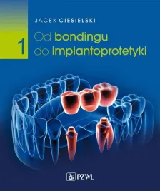 od-bondingu-do-implantoprotetyki-cz-i