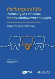 periimplantitis-profilaktyka-i-leczenie-tkanek