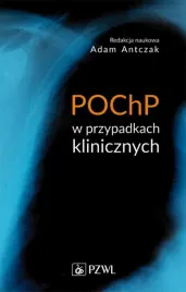 pochp-w-przypadkach-klinicznych-adam-antczak